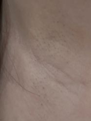 体验后-伽美医疗美容医院·高端抗衰中心