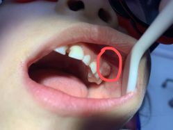 -青苗儿童口腔(长楹天街购物中心)