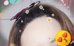 -大麦微针植发全国连锁