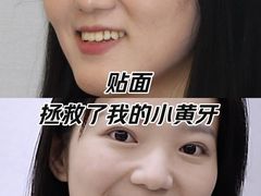-优诺口腔(华东总院)