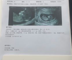 -上海艾儿贝佳妇产科医院