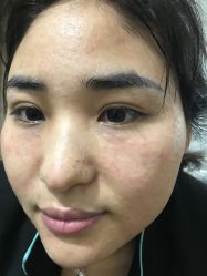-洁铭新加坡医美