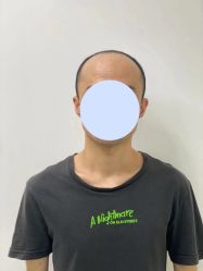 -发饰美男士增发补发假发定制店