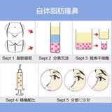 害怕手术的看过来！非手术隆鼻法介绍～