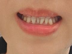 -微笑牙科口腔(三亚迎宾院区)