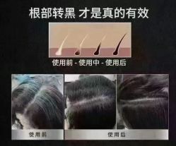 -希梵尔头皮抗衰·科技养发