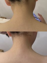 点击看大图 -ANNIL安奈尔·NASX超透白·科技抗衰·问题性肌肤管理