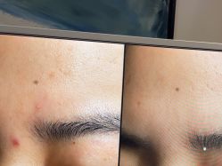 -苑苑vbeauty科技美容SPA