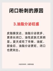 -克丽缇娜