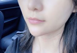 -美莱医学美容医院