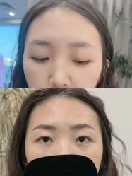 点击看大图 -张小野·专业半永久纹眉