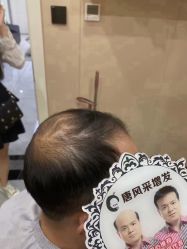 -唐风采假发补发定制