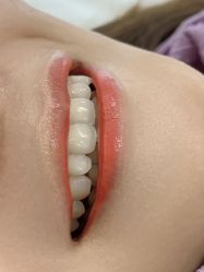 -张小野·专业半永久纹眉