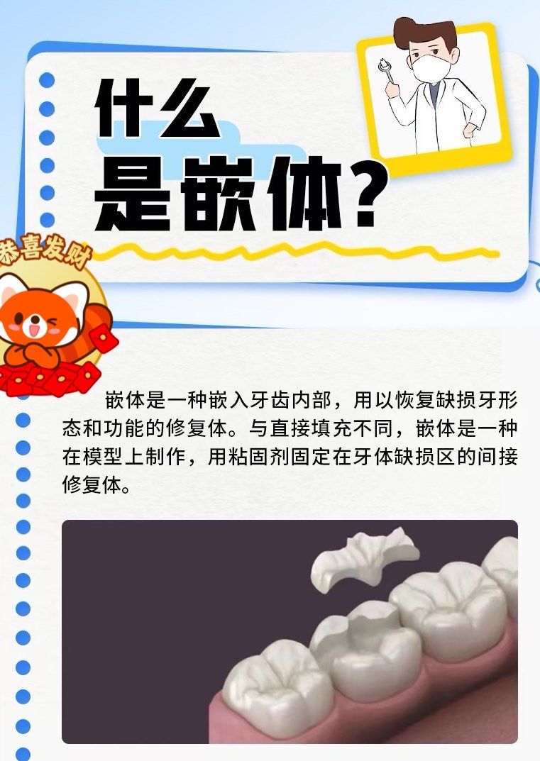 什么是嵌体?