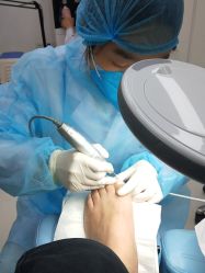 -派恩宜灰指甲鸡眼嵌甲手足癣