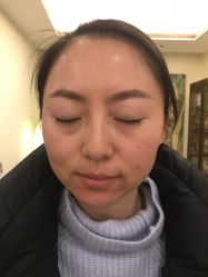 -皇族养心堂·净痘·修敏·御颜