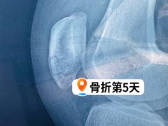 -中国人民解放军总医院