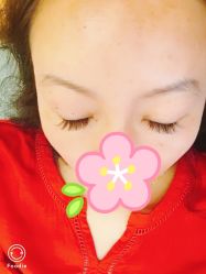 点击看大图 -初樱科技美学问题肌修复中心