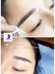 点击看大图 -美肤盾祛痘·问题肌头疗管理中心