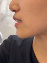 -长沙雅美医疗美容医院