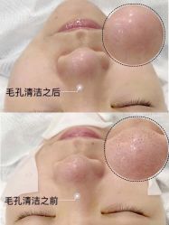 -美肤盾祛痘·问题肌头疗管理中心