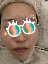 -苗方清颜痘肌研究所