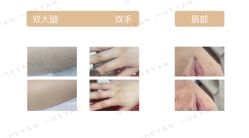 -HEYAN荷妍专业脱毛连锁机构