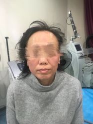 -八大处整形