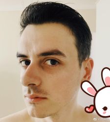 -大麦微针植发丨全国连锁