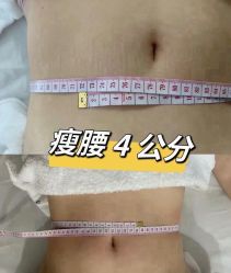 -Lily纤美·科技减脂中心