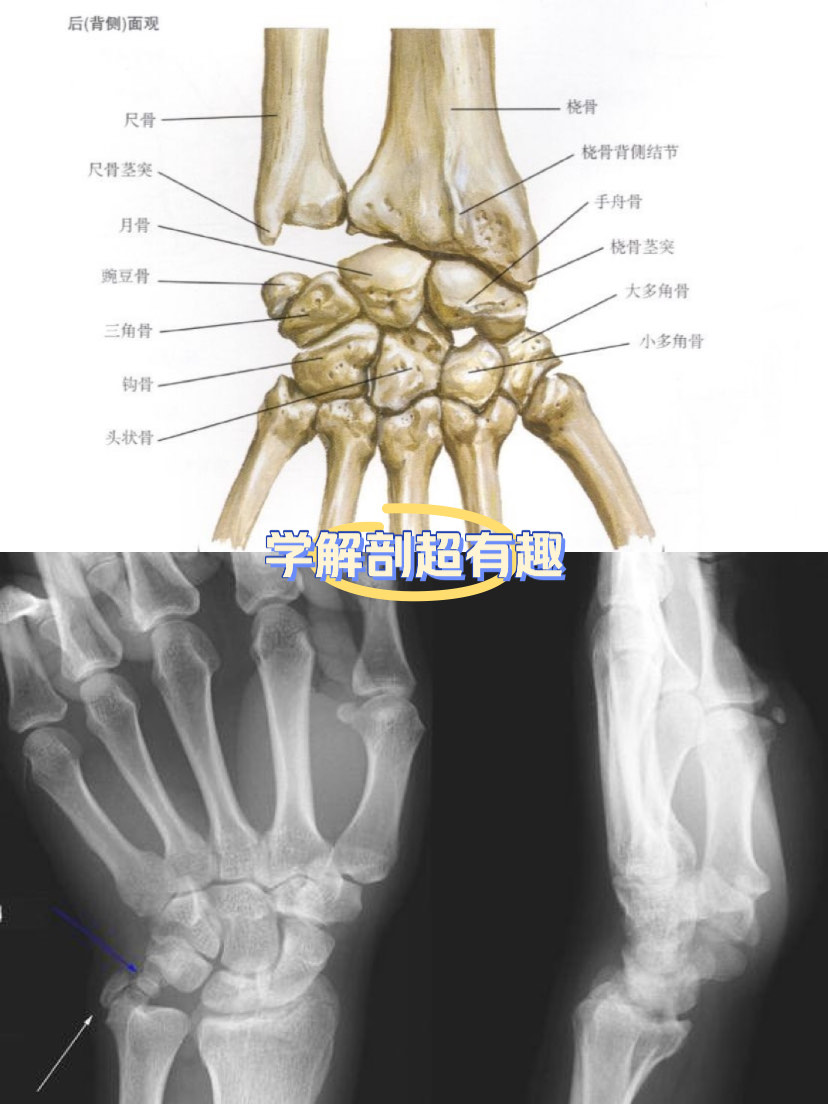 手腕骨部位名称图解图片