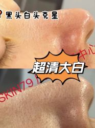-SKIN79皮肤管理中心