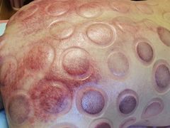 -沈师傅盲人按摩工作室(密三小区店)