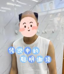 点击看大图 -发饰美男士增发补发假发定制店