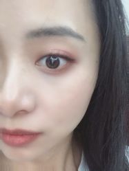 -More摩尔医美の注射线雕光电中心