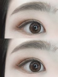 -宥莉·ULLY 痘敏肌•科技皮肤管理中心