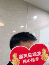 -唐风采假发补发定制