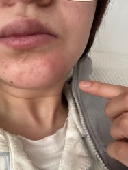 -天津健丽·去眼袋医疗美容机构