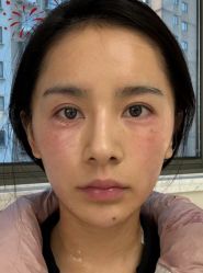 点击看大图 -Yestar艺星医疗美容医院