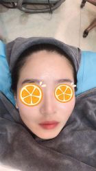 体验前-More摩尔医美の注射线雕光电中心
