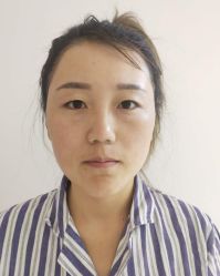 体验前-华臣医疗美容