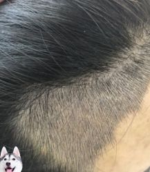 -大麦微针植发丨全国连锁