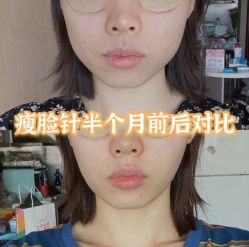 -上海漾颜医疗美容