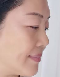 -四川米兰柏羽医学美容医院