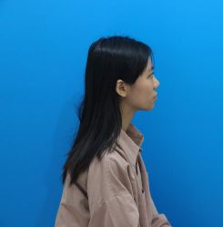 点击看大图 体验前-鑫元辰医疗美容整形