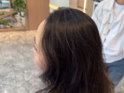 -碧莲盛·不剃发植发