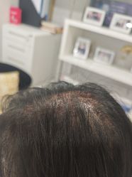 -熙朵美学植发·连锁品牌