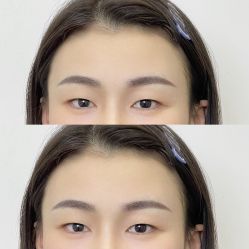 -杨益美学·野生眉半永久纹眉发际线