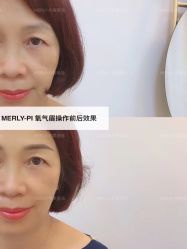 -MLP美丽派·问题肌疗愈中心