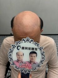 -唐风采假发补发定制